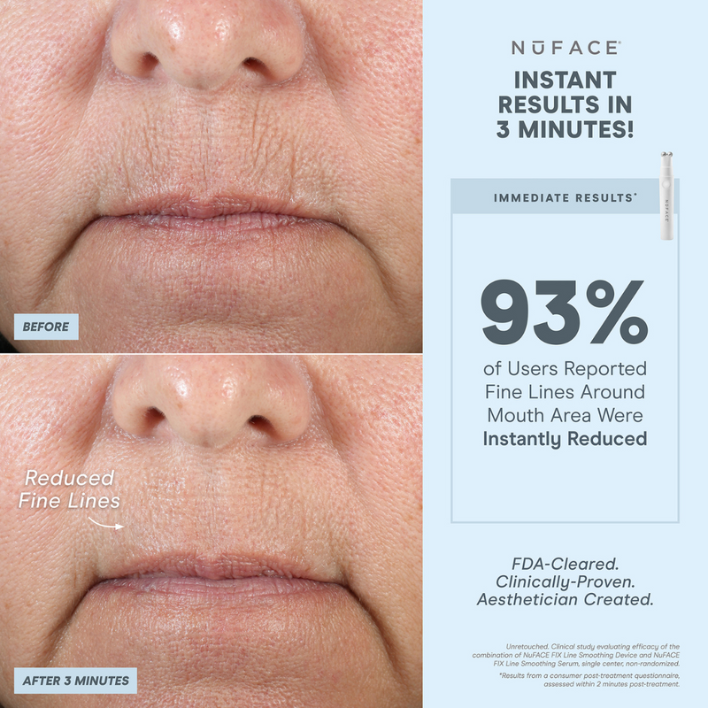 NuFACE Fix Line Smoothing Device